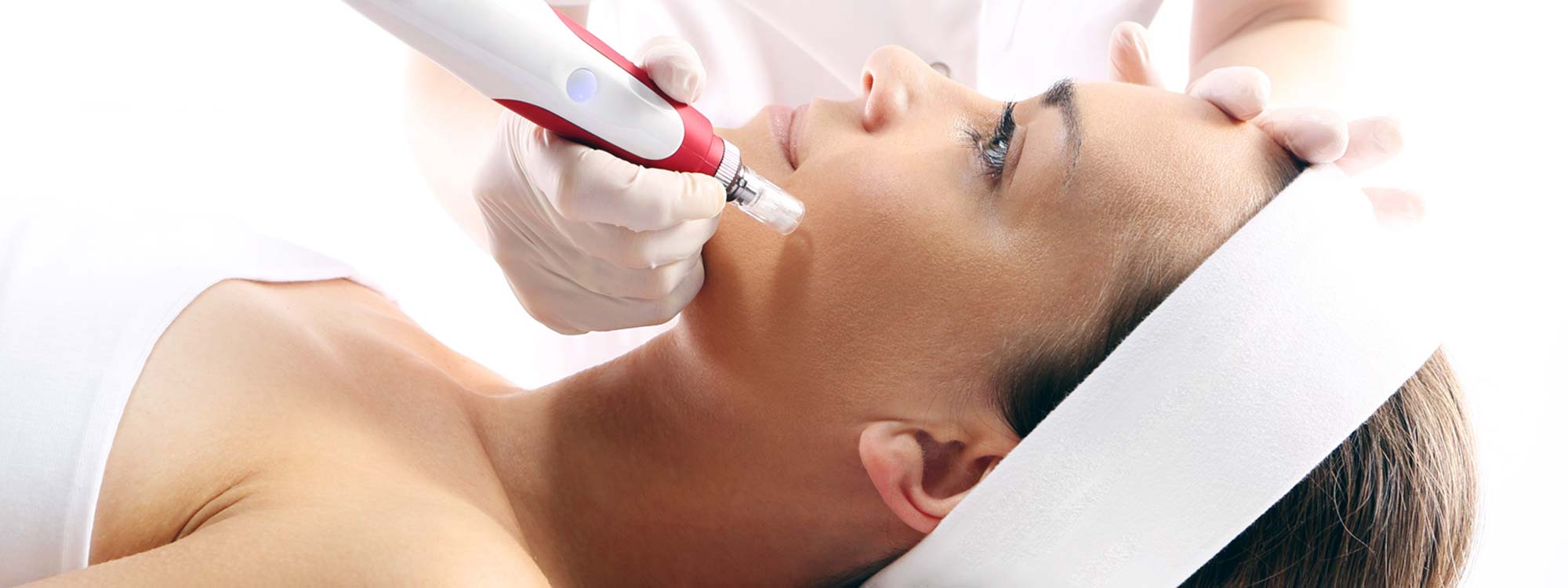 Microneedling Holzwickede